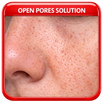 Open Pores Solution