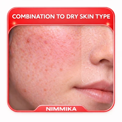 Combination to Dry Skin